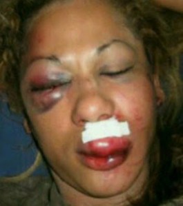 1woman badly beaten by husband lindaikejiblog