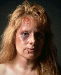 Battered-Womens-Syndrome-1