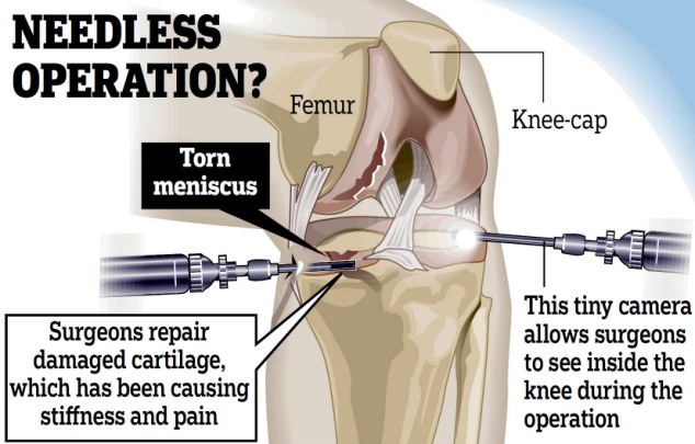 knee surgery